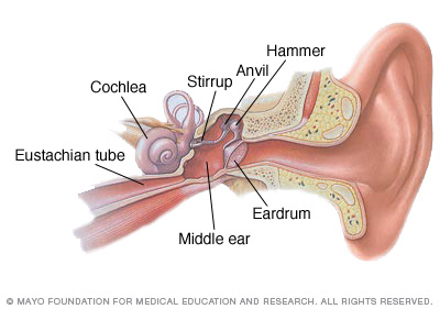 Osteoporosis causes bone loss and weakens the bones in the inner ear commonly resulting in hearing loss.