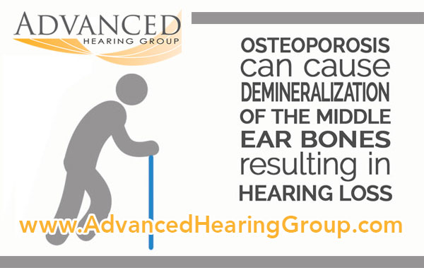 Connection between osteoporosis and hearing loss