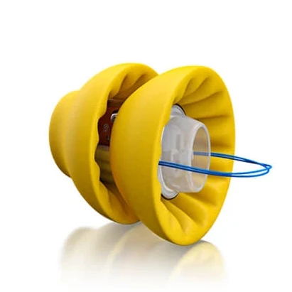 allergies and hearing loss